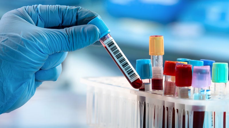 The Prognosis for In Vitro Diagnostics